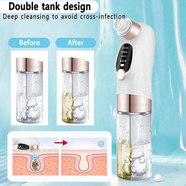 DeepClean Power Pore Vacuum Pro