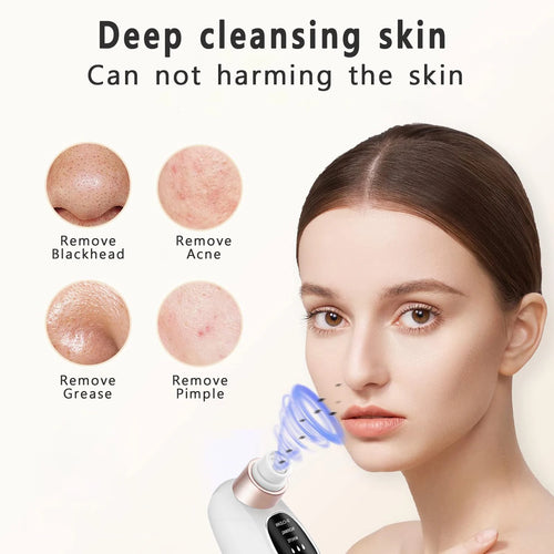 DeepClean Power Pore Vacuum Pro